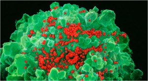 HIV NIBSC/Photo Researchers A colored scanning electron micrograph of a T-lymphocyte blood cell (green) infected with Human Immunodeficiency virus (HIV).